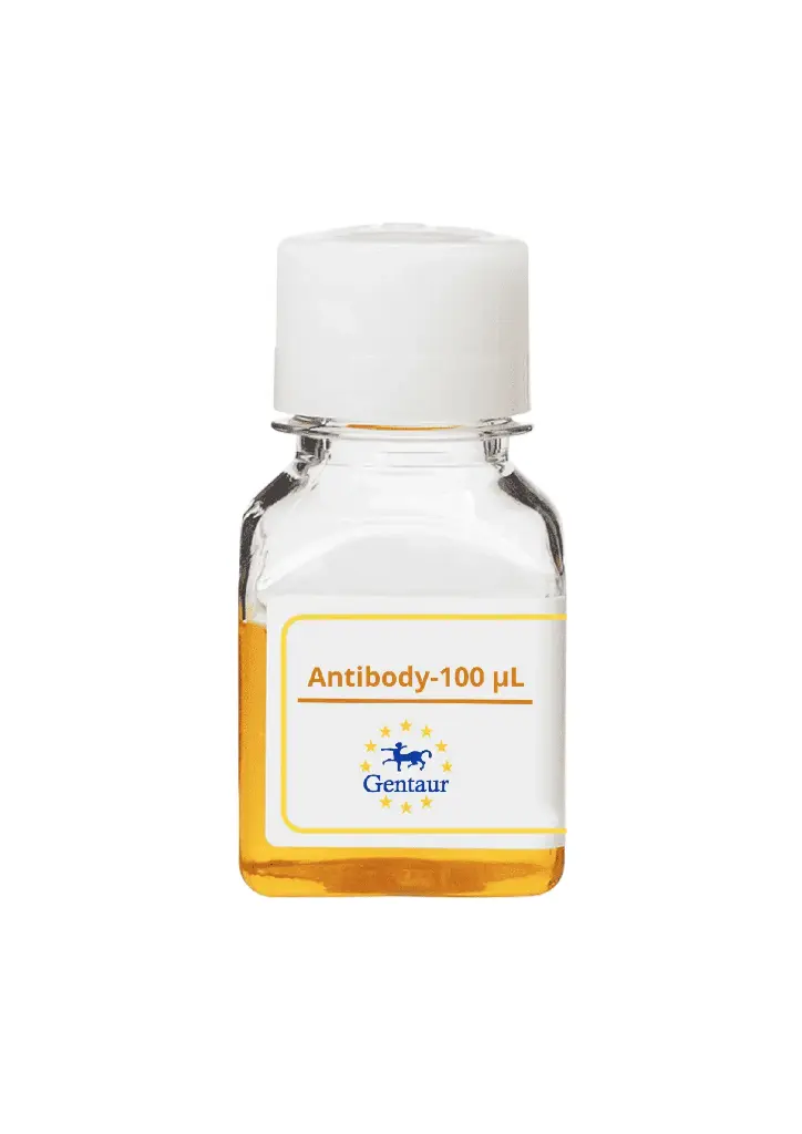 ALKBH1 Antibody   